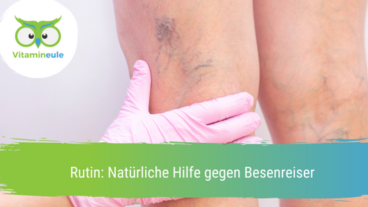 Rutin: Natürliche Hilfe gegen Besenreiser